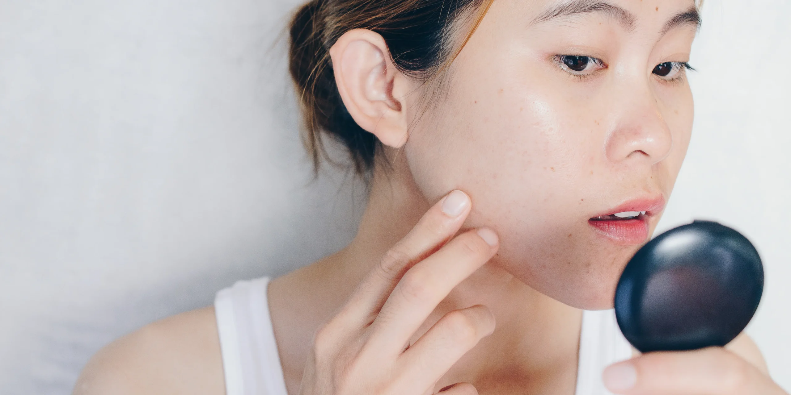 Understanding What Really Causes Acne – And How To Treat It Effectively